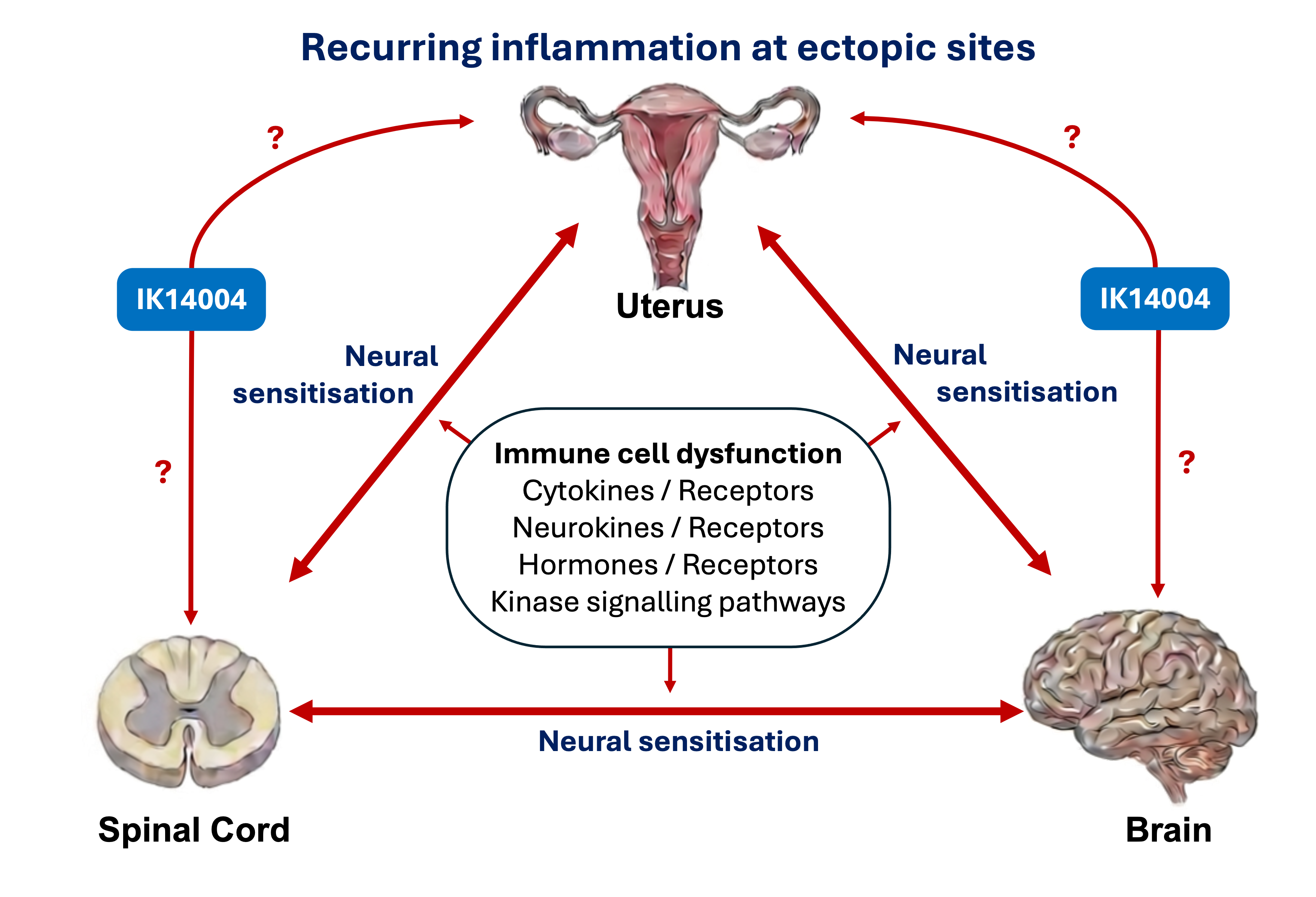 Illustration of endometriosis and immune dysfunction
